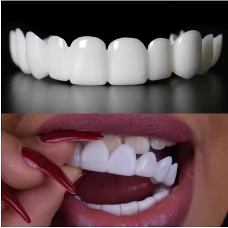 BlissBite™ Snap-On Veneers
