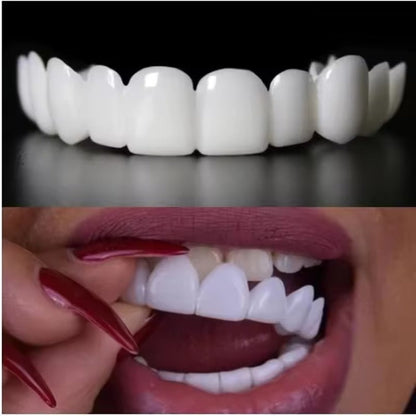 BlissBite™ Snap-On Veneers